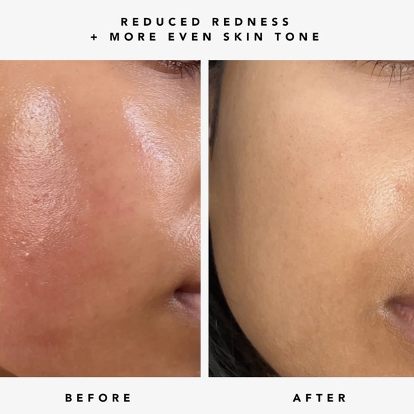 $12❤️‍🔥 Herbivore Botanicals NOVA 15% Vitamin C + Turmeric Brightening Serum - Picture 4 of 8